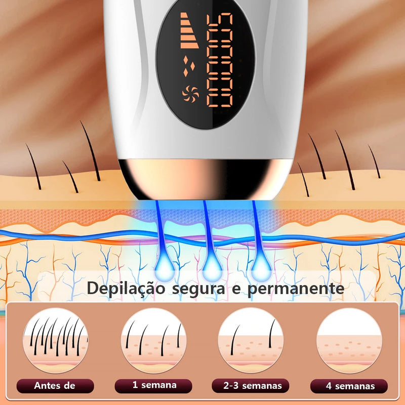 (SUPER LANÇAMENTO) • Removedor de Pelos Permanente e Indolor (APROVADO FDA)